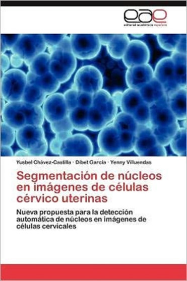Segmentacion de nucleos en imagenes de celulas cervico uterinas by Chavez-Castilla Yusbel - Paperback