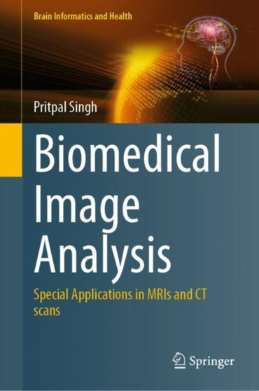 Biomedical Image Analysis : Special Applications in MRIs and CT scans by Pritpal Singh - Hardback