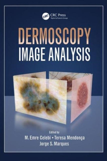 Dermoscopy Image Analysis by M.Emre Celebi - Hardback