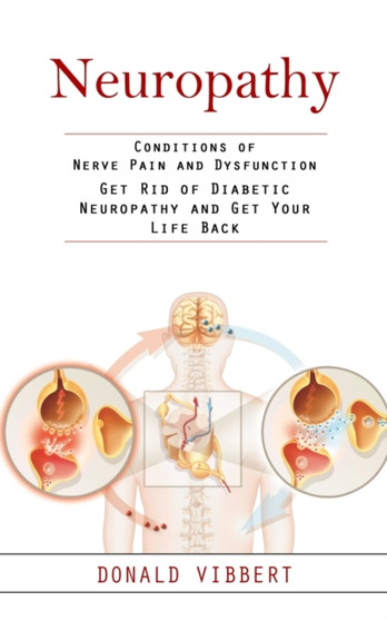 Neuropathy : Conditions of Nerve Pain and Dysfunction (Get Rid of Diabetic Neuropathy and Get Your Life Back)