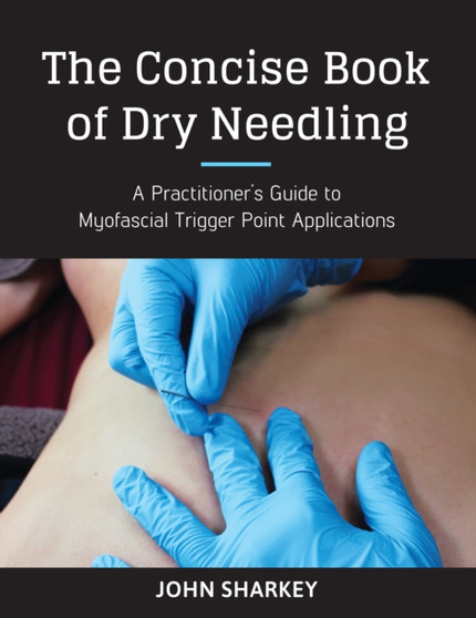 The Concise Book of Dry Needling : A Practitioner's Guide to Myofascial Trigger Point Applications