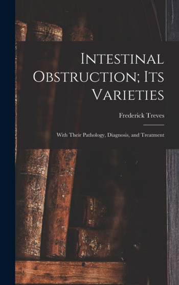 Intestinal Obstruction; Its Varieties : With Their Pathology, Diagnosis, and Treatment