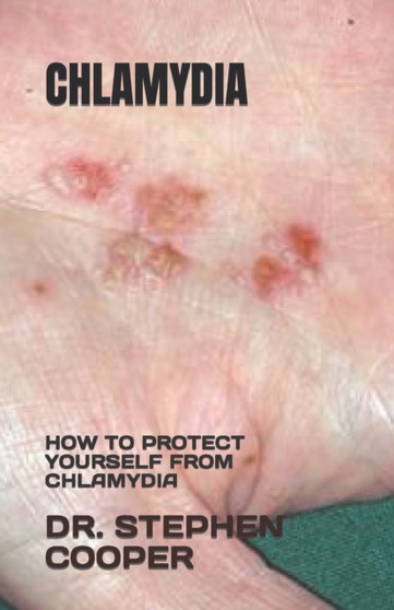 CHLAMYDIA : HOW TO PROTECT YOURSELF FROM CHLAMYDIA