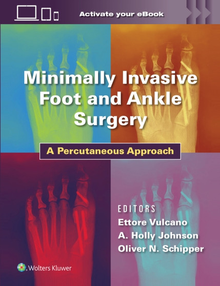 Minimally Invasive Foot and Ankle Surgery : A Percutaneous Approach by Dr.Ettore MD Vulcano - Hardback