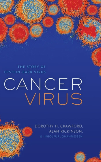 Cancer Virus : The story of Epstein-Barr Virus by Dorothy H. Crawford - Hardback
