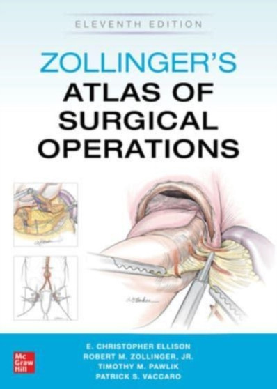 Zollinger's Atlas of Surgical Operations, Eleventh Edition by Robert Zollinger - Paperback