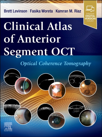 Clinical Atlas of Anterior Segment OCT: Optical Coherence Tomography by Brett Levinson - Hardback