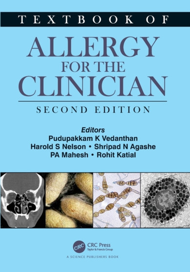 Textbook of Allergy for the Clinician by Pudupakkam K. Vedanthan - Paperback