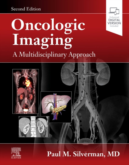 Oncologic Imaging: A Multidisciplinary Approach by Paul M. Silverman - Hardback