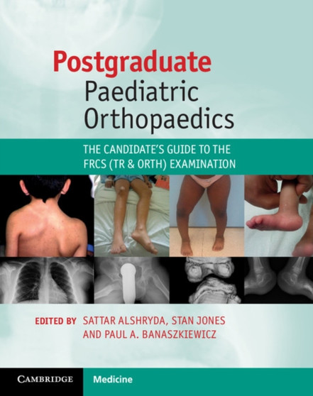 Postgraduate Paediatric Orthopaedics : The Candidate's Guide to the FRCS (Tr and Orth) Examination by Sattar Alshryda - Paperback