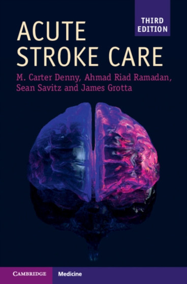 Acute Stroke Care by Mary Carter Denny - Paperback