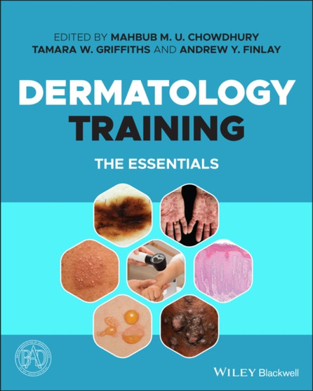 Dermatology Training : The Essentials by Mahbub M.U. Chowdhury - Paperback
