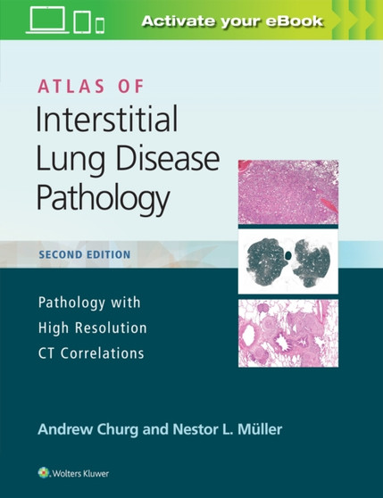Atlas of Interstitial Lung Disease Pathology by Andrew Churg - Hardback