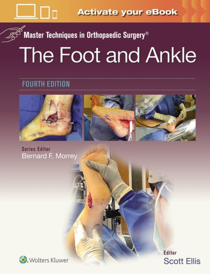 Master Techniques in Orthopaedic Surgery: The Foot and Ankle by Scott Ellis - Hardback
