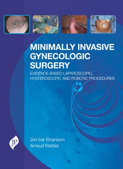 Minimally Invasive Gynecologic Surgery: Evidence-Based Laparoscopic, Hysteroscopic & Robotic Surgeries by Jon Ivar Einarsson - Hardback