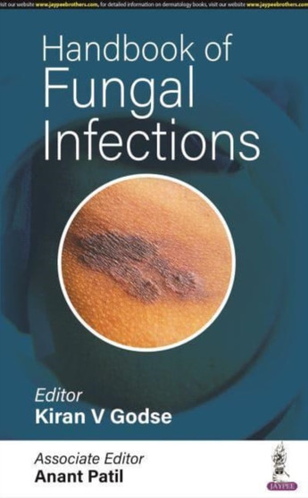 Handbook of Fungal Infections by Kiran V Godse - Paperback