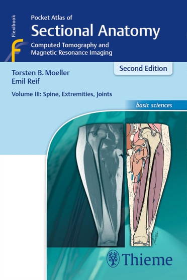Pocket Atlas of Sectional Anatomy, Volume III: Spine, Extremities, Joints : Computed Tomography and Magnetic Resonance Imaging by Torsten Bert Moller - Paperback