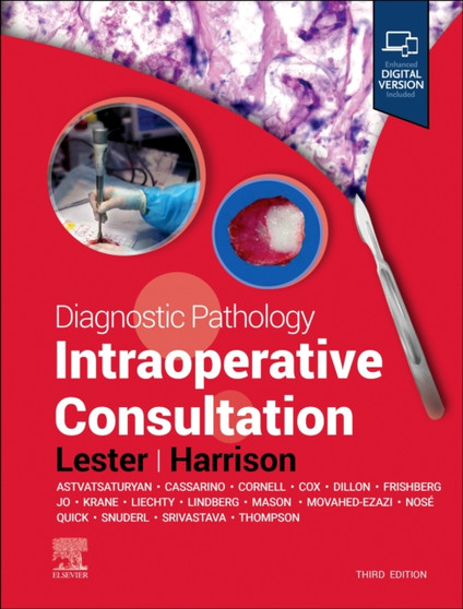 Diagnostic Pathology: Intraoperative Consultation by Susan C. Lester - Hardback