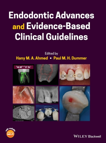 Endodontic Advances and Evidence-Based Clinical Guidelines by Hany M.A. Ahmed - Hardback