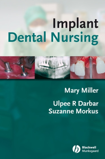 Implant Dental Nursing by Ulpee R. Darbar - Paperback