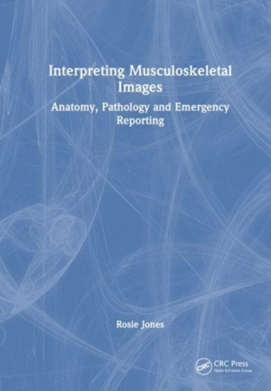 Interpreting Musculoskeletal Images : Anatomy, Pathology and Emergency Reporting by Rosie Jones - Hardback