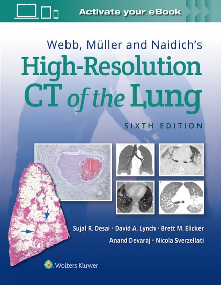 Webb, Muller and Naidich's High-Resolution CT of the Lung by Sujal Desai - Hardback