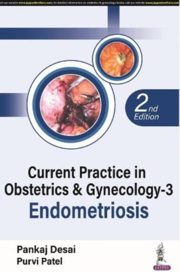 Current Practice in Obstetrics & Gynecology - 3 : Endometriosis by Pankaj Desai - Paperback