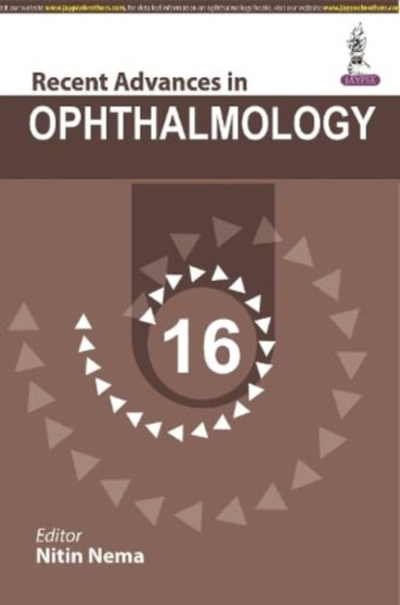 Recent Advances in Ophthalmology - 16 by Nitin Nema - Paperback