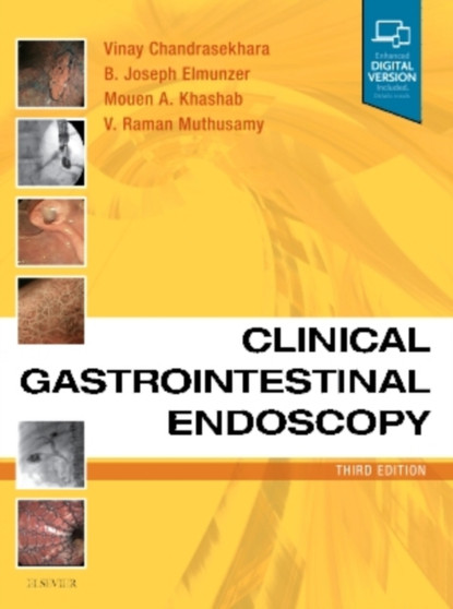 Clinical Gastrointestinal Endoscopy by Vinay Chandrasekhara - Hardback
