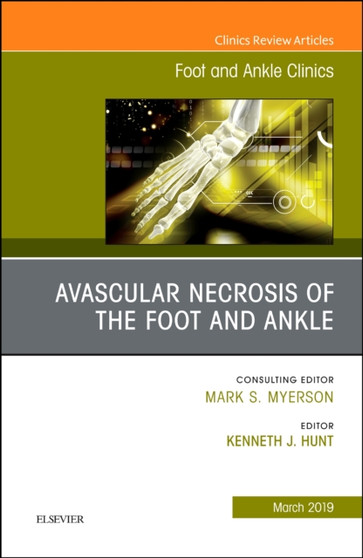 Avascular necrosis of the foot and ankle, An issue of Foot and Ankle Clinics of North America : Volume 24-1 by Kenneth J MD Hunt - Hardback