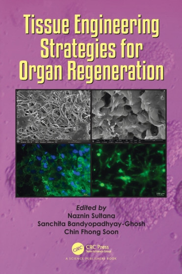 Tissue Engineering Strategies for Organ Regeneration by Naznin Sultana - Hardback