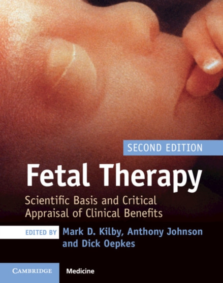 Fetal Therapy : Scientific Basis and Critical Appraisal of Clinical Benefits by Mark D. Kilby - Hardback