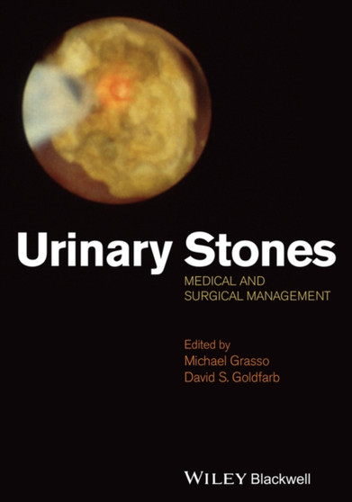 Urinary Stones : Medical and Surgical Management by Michael III Grasso - Hardback
