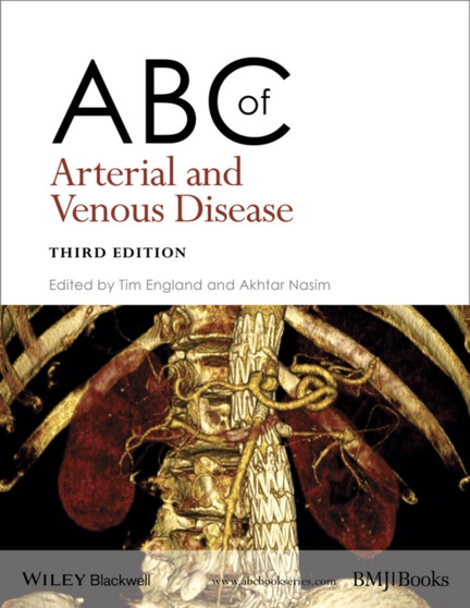 ABC of Arterial and Venous Disease by Tim England - Paperback