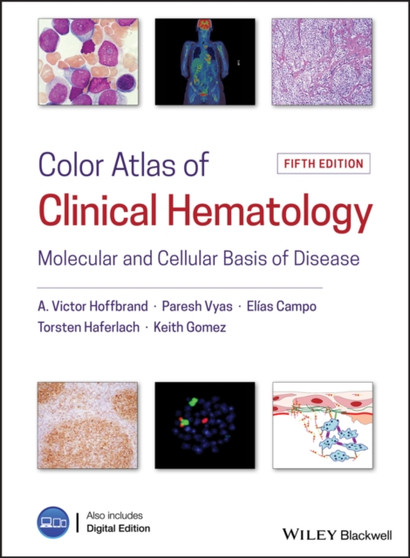 Color Atlas of Clinical Hematology : Molecular and Cellular Basis of Disease by Victor Hoffbrand - Hardback