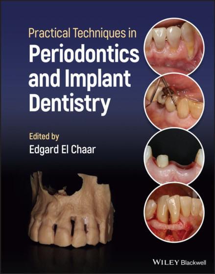 Practical Techniques in Periodontics and Implant Dentistry by Edgard El Chaar - Hardback
