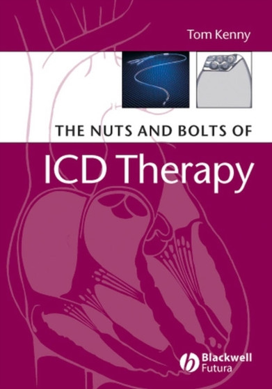 The Nuts and Bolts of ICD Therapy by Tom Kenny - Paperback