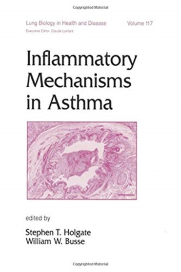 Inflammatory Mechanisms in Asthma by Stephen Holgate - Hardback