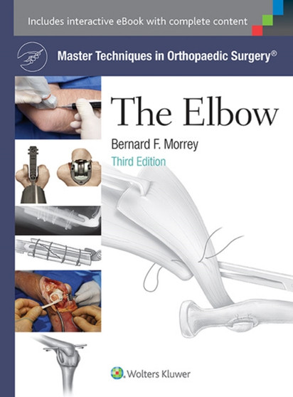Master Techniques in Orthopaedic Surgery: The Elbow by Bernard F. MD Morrey - Hardback