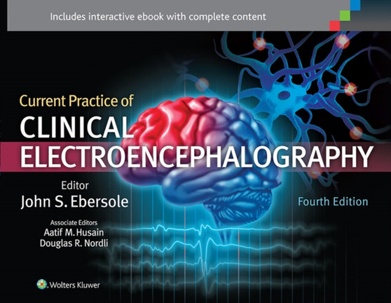Current Practice of Clinical Electroencephalography by Dr.John S. MD Ebersole - Hardback