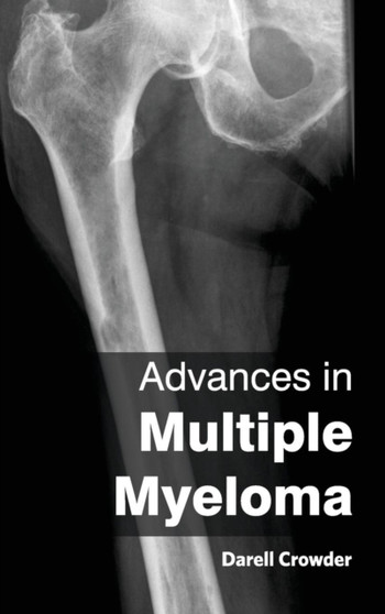 Advances in Multiple Myeloma by Darell Crowder - Hardback