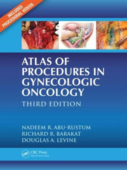 Atlas of Procedures in Gynecologic Oncology by Nadeem R. Abu-Rustum - Hardback