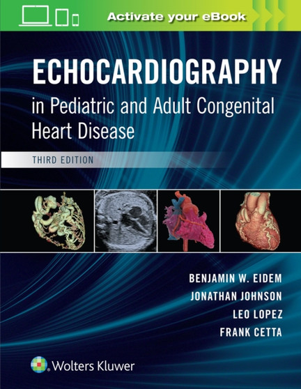 Echocardiography in Pediatric and Adult Congenital Heart Disease by Benjamin W. MD FACC FASE Eidem - Hardback