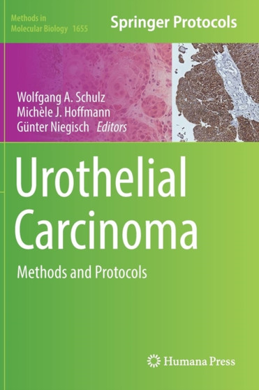 Urothelial Carcinoma : Methods and Protocols : 1655 by Wolfgang A Schulz - Hardback