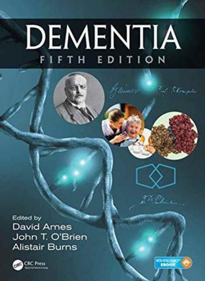 Dementia by David Ames - Hardback