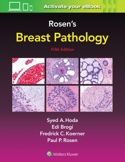 Rosen's Breast Pathology by Syed A. Hoda - Hardback