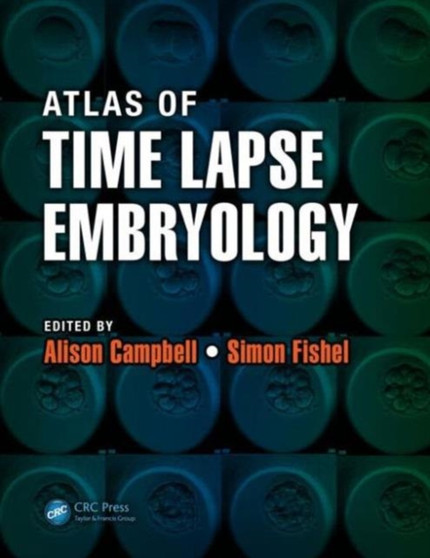 Atlas of Time Lapse Embryology by Alison Campbell - Paperback