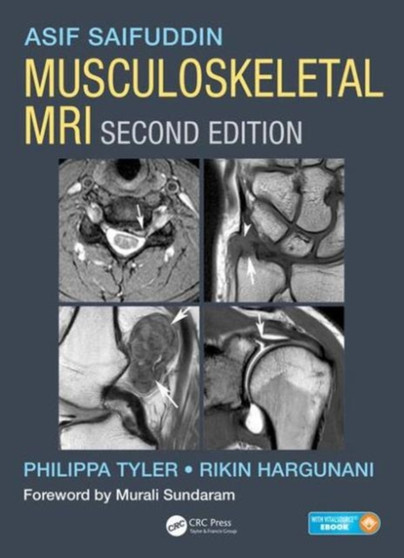 Musculoskeletal MRI by Asif Saifuddin - Hardback
