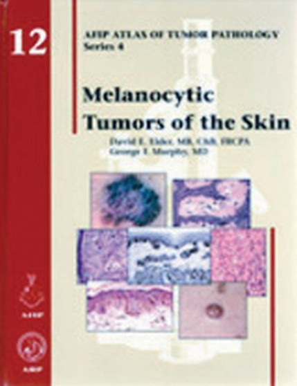 Melanocytic Tumors of the Skin by David E. Elder - Hardback