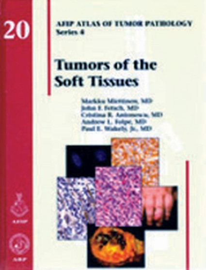 Tumors of the Soft Tissues by Markku Miettinen - Hardback